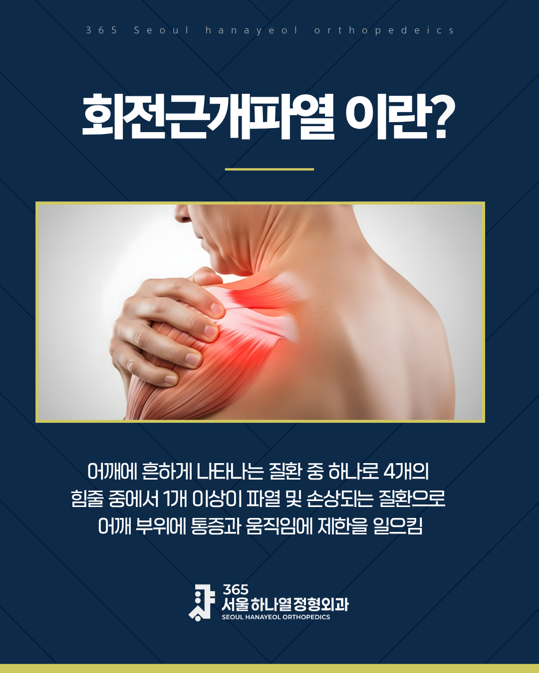 회전근개파열을 보여주는 이미지